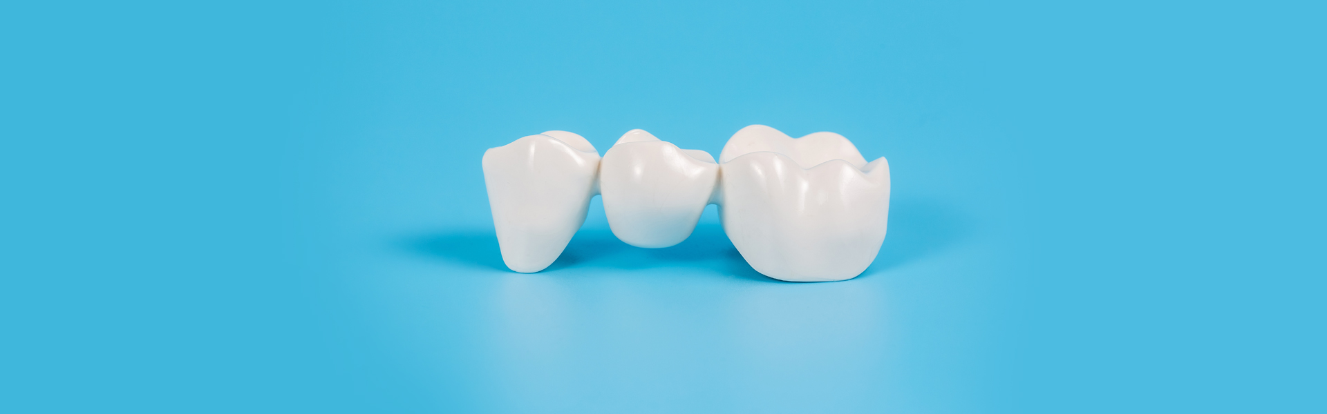 5 Factors Considered During a Dental Crown Placement Procedure