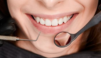 The Importance of Professional Teeth Cleaning