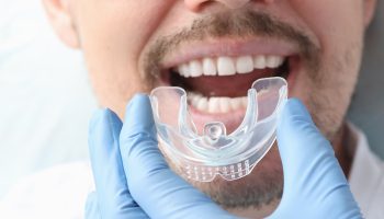 What are the Benefits of Wearing Mouth Guards in Phoenix, AZ